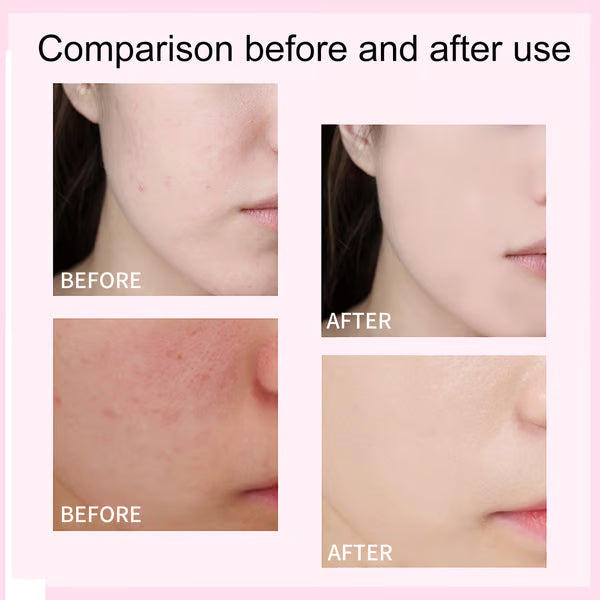 Eelhoe - CC+ Cream IT Cosmatics