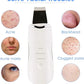 3-in-1 Ultrasonic Facial Skin Scrubber