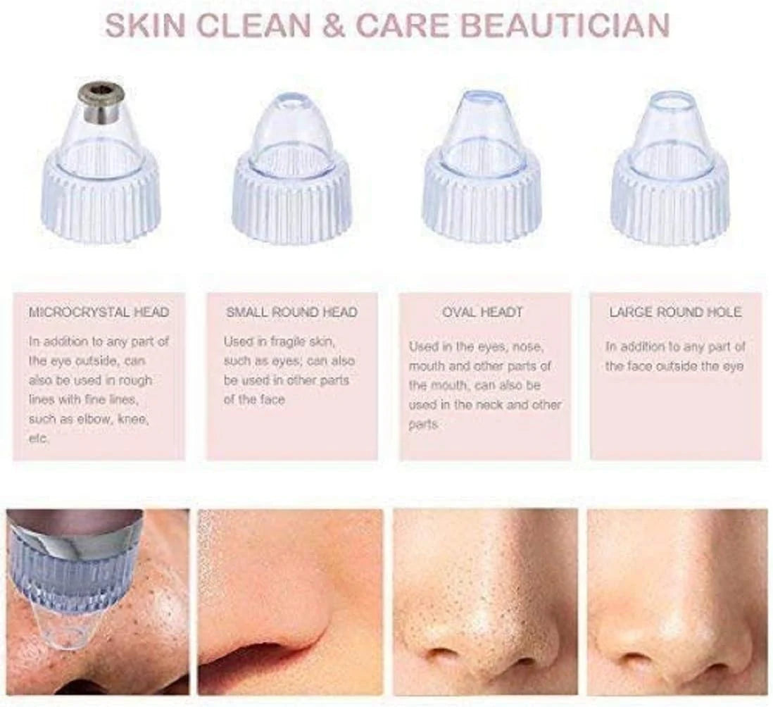 DermaSuction Face Pore Cleansing Beauty Instrument
